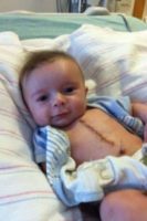 Three Months Old Baby Becomes Internet Sensation After Open Heart Surgery